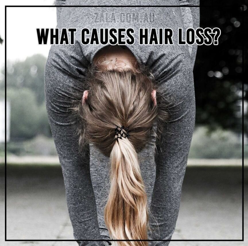 What Causes Hair Loss?
