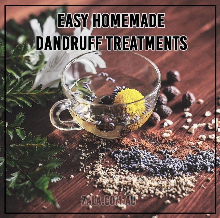 Easy Homemade Dandruff Treatments